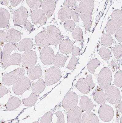 Immunohistochemistry-Paraffin: HDAC1 Antibody (CL0510) [NBP2-52937]