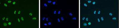 Immunocytochemistry/ Immunofluorescence: HDAC1 Antibody [NBP2-54621]