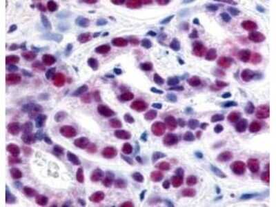 Immunohistochemistry: HDAC1 Antibody [NBP1-78101]