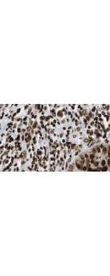 Immunohistochemistry: HDAC1 Antibody [NBP1-78101]