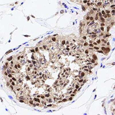Immunohistochemistry-Paraffin: HDAC1 Antibody [NB100-56340]