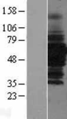 Western Blot: HDAC1 Overexpression Lysate [NBL1-11477]