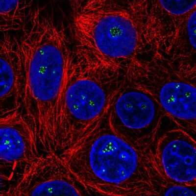 Immunocytochemistry/ Immunofluorescence: HDAC10 Antibody [NBP2-56663]