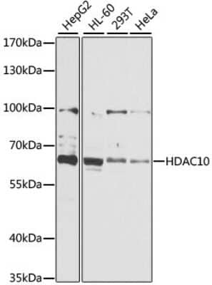 Western Blot: HDAC10 AntibodyBSA Free [NBP3-04562]