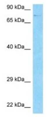 Western Blot: HDAC10 Antibody [NBP3-09973]