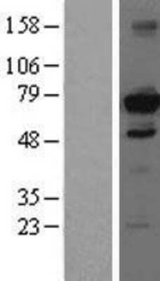 Western Blot: HDAC10 Overexpression Lysate [NBL1-11478]