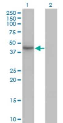 Western Blot: HDAC11 Antibody (1C2-2G5) [H00079885-M01]