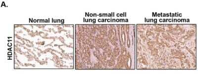 Immunohistochemistry: HDAC11 Antibody [NBP2-16789]