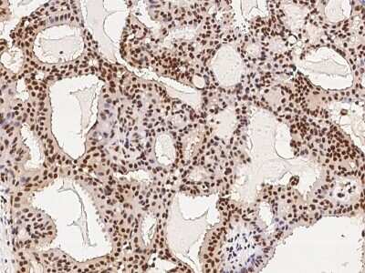 Immunohistochemistry-Paraffin: HDAC11 Antibody [NBP2-98764]