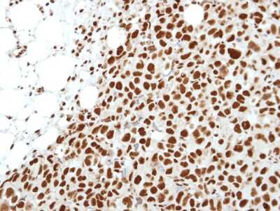 Immunohistochemistry-Paraffin: Histone Deacetylase 2/HDAC2 Antibody [NBP2-16790]