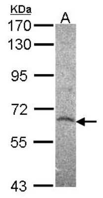 Western Blot: Histone Deacetylase 2/HDAC2 Antibody [NBP2-16790]