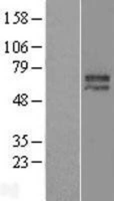 Western Blot: Histone Deacetylase 2/HDAC2 Overexpression Lysate [NBL1-11480]