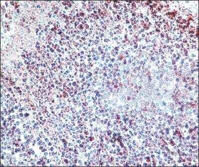 Immunohistochemistry: HDAC3 Antibody - BSA Free [NB500-126]