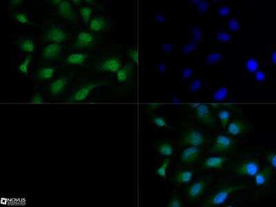 Immunocytochemistry/ Immunofluorescence: HDAC3 Antibody [NB100-1669]
