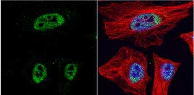 Immunocytochemistry/ Immunofluorescence: HDAC3 Antibody [NBP2-16791]