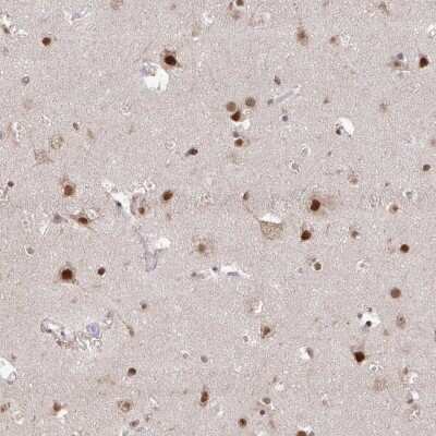 Immunohistochemistry: HDAC3 Antibody [NBP2-47439]