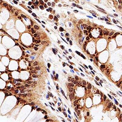 Immunohistochemistry-Paraffin: HDAC3 Antibody [NB100-1669]