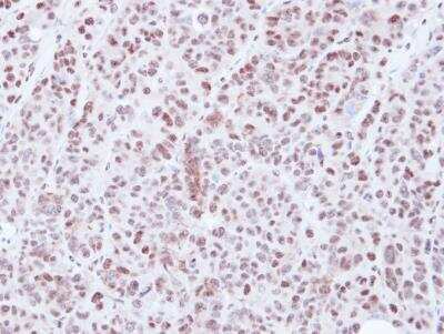 Immunohistochemistry-Paraffin: HDAC3 Antibody [NBP1-31196]