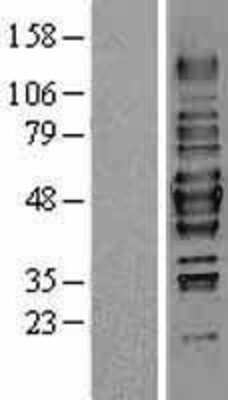 Western Blot: HDAC3 Overexpression Lysate [NBL1-11481]