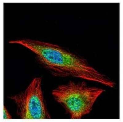 Immunocytochemistry/ Immunofluorescence: Histone Deacetylase 4/HDAC4 Antibody [NBP2-16793]