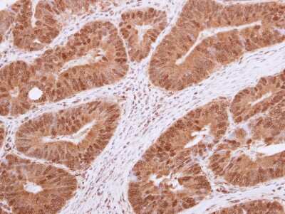 Immunohistochemistry-Paraffin: Histone Deacetylase 4/HDAC4 Antibody [NBP2-16793]