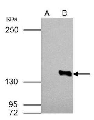 Immunoprecipitation: Histone Deacetylase 4/HDAC4 Antibody [NBP2-16793]
