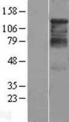 Western Blot: Histone Deacetylase 4/HDAC4 Overexpression Lysate [NBL1-11482]