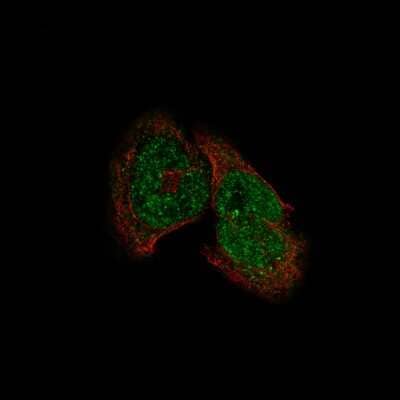 Immunocytochemistry/ Immunofluorescence: HDAC5 Antibody (CL8121) [NBP2-88913]