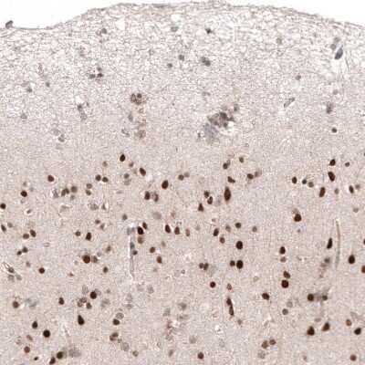 Immunohistochemistry-Paraffin: HDAC5 Antibody (CL8121) [NBP2-88913]