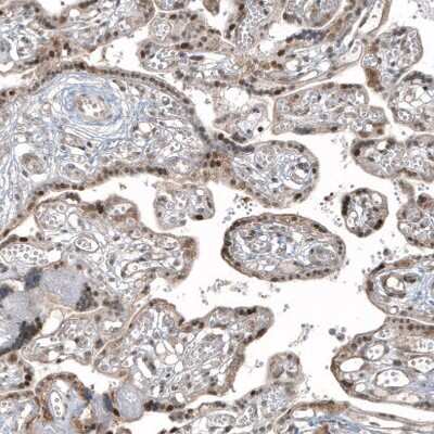 Immunohistochemistry-Paraffin: HDAC5 Antibody (CL8121) [NBP2-88913]