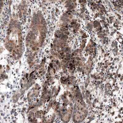 Immunohistochemistry-Paraffin: HDAC5 Antibody (CL8121) [NBP2-88913]