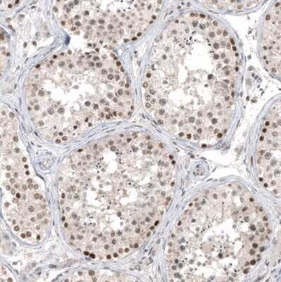 Immunohistochemistry-Paraffin: HDAC5 Antibody (CL8121) [NBP2-88913]