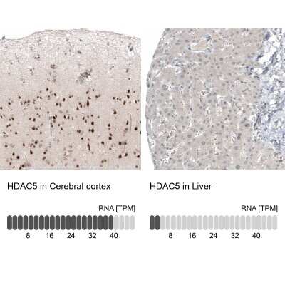 Immunohistochemistry-Paraffin: HDAC5 Antibody (CL8121) [NBP2-88913]