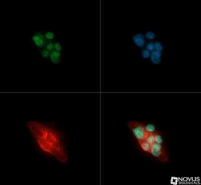 Immunocytochemistry/ Immunofluorescence: HDAC5 Antibody - BSA Free [NBP2-22152]