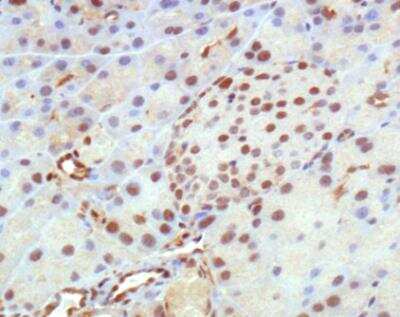 Immunohistochemistry: HDAC5 Antibody - BSA Free [NBP2-22152]