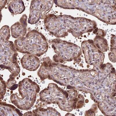 Immunohistochemistry-Paraffin: HDAC5 Antibody [NBP1-83436]