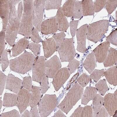 Immunohistochemistry-Paraffin: HDAC5 Antibody [NBP1-83436]