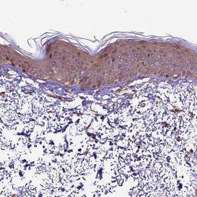 Immunohistochemistry-Paraffin: HDAC5 Antibody [NBP1-83436]