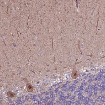 Immunohistochemistry-Paraffin: HDAC5 Antibody [NBP1-83436]