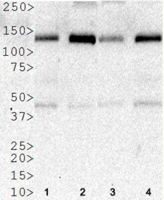 Western Blot: HDAC5 AntibodyBSA Free [NBP2-22152]