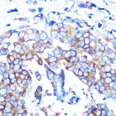 Immunohistochemistry-Paraffin: HDAC6 Antibody (9V1W2) [NBP3-16082]