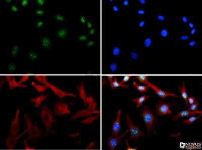 Immunocytochemistry/ Immunofluorescence: HDAC6 Antibody - BSA Free [NBP1-78981]