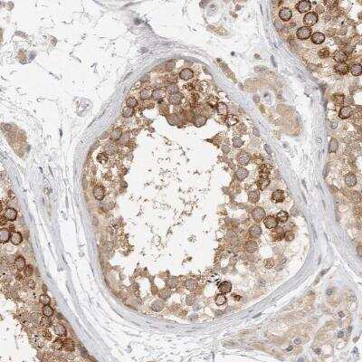 Immunohistochemistry-Paraffin: HDAC6 Antibody [NBP1-82212]