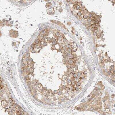 Immunohistochemistry-Paraffin: HDAC6 Antibody [NBP1-82213]