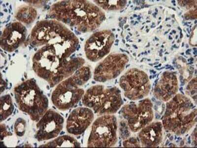 Immunohistochemistry: HDAC6 Antibody (OTI1B3) - Azide and BSA Free [NBP2-71531]