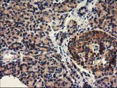 Immunohistochemistry: HDAC6 Antibody (OTI1B3) - Azide and BSA Free [NBP2-71531]