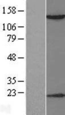 Western Blot: HDAC6 Overexpression Lysate [NBL1-11484]