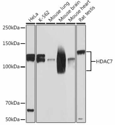 Western Blot: HDAC7 Antibody (6J2N9) [NBP3-15457]