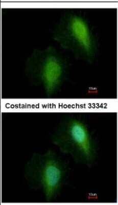 Immunocytochemistry/ Immunofluorescence: HDAC7 Antibody [NBP2-16795]