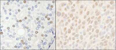 Immunohistochemistry-Paraffin: HDAC7 Antibody [NB100-61587]